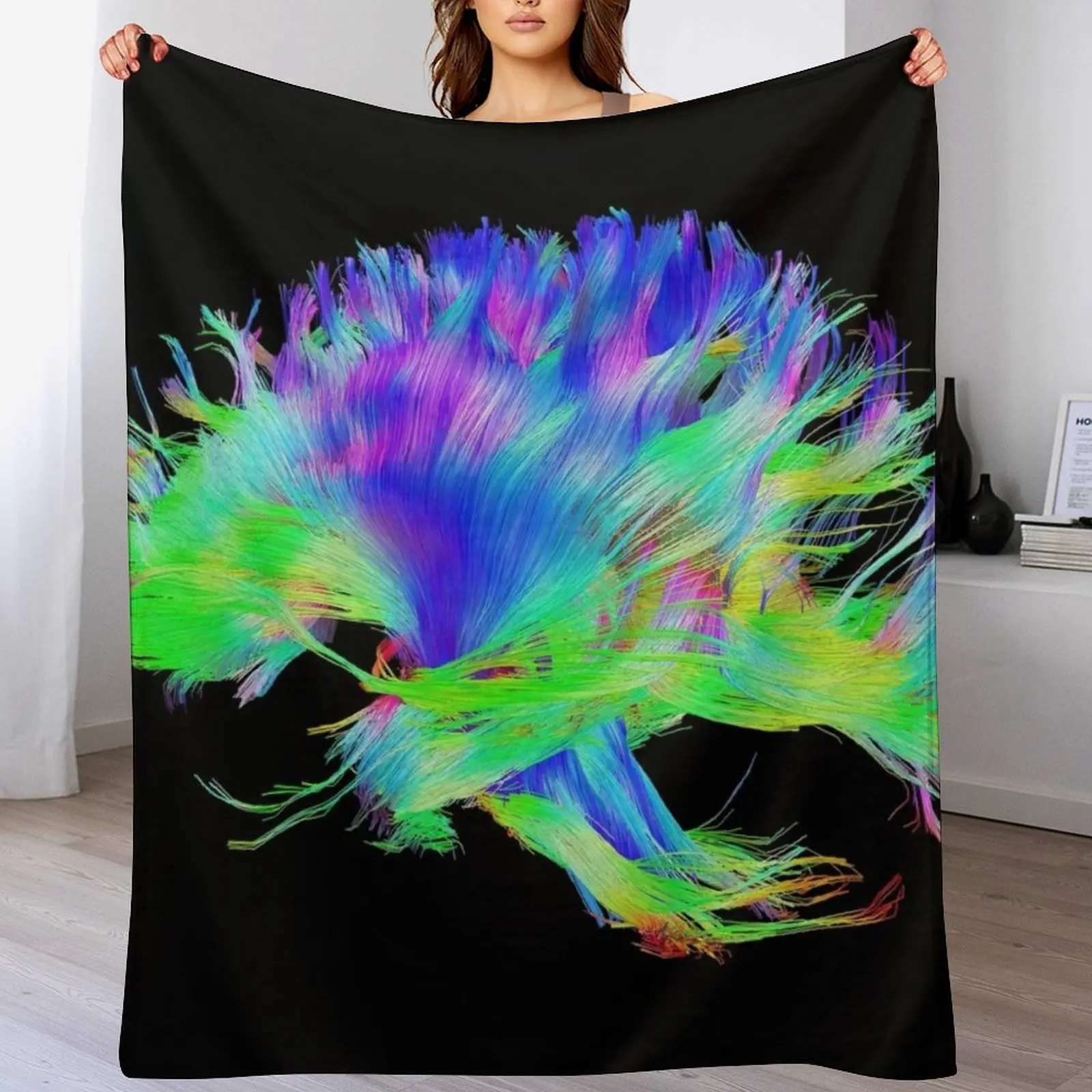 3D Printing For Medical - Fiber Tracts Of The Brain, Dti,