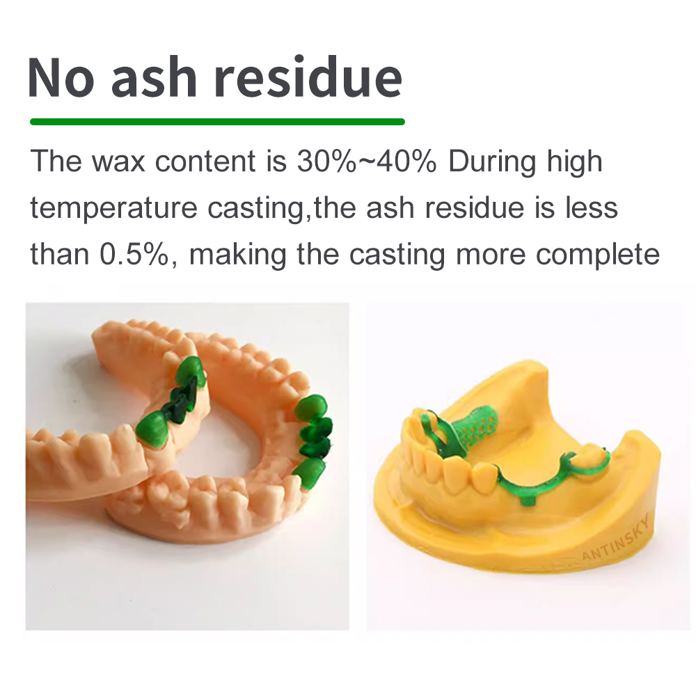 Antinsky Castable Dental Smart - 3D Printing Dental review and price