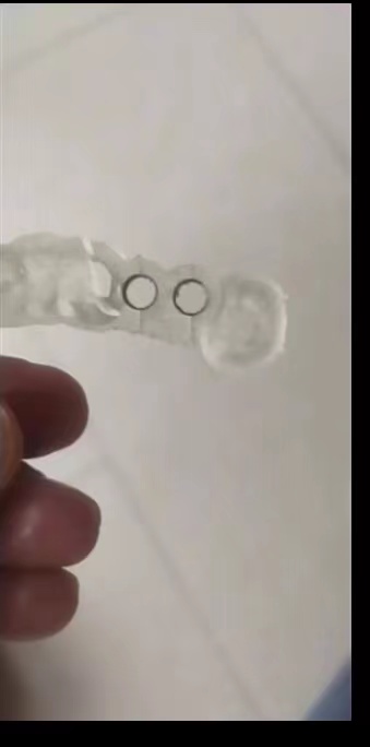 Resin Dental 3D Printer Planti - 3D Printing Dental review and price