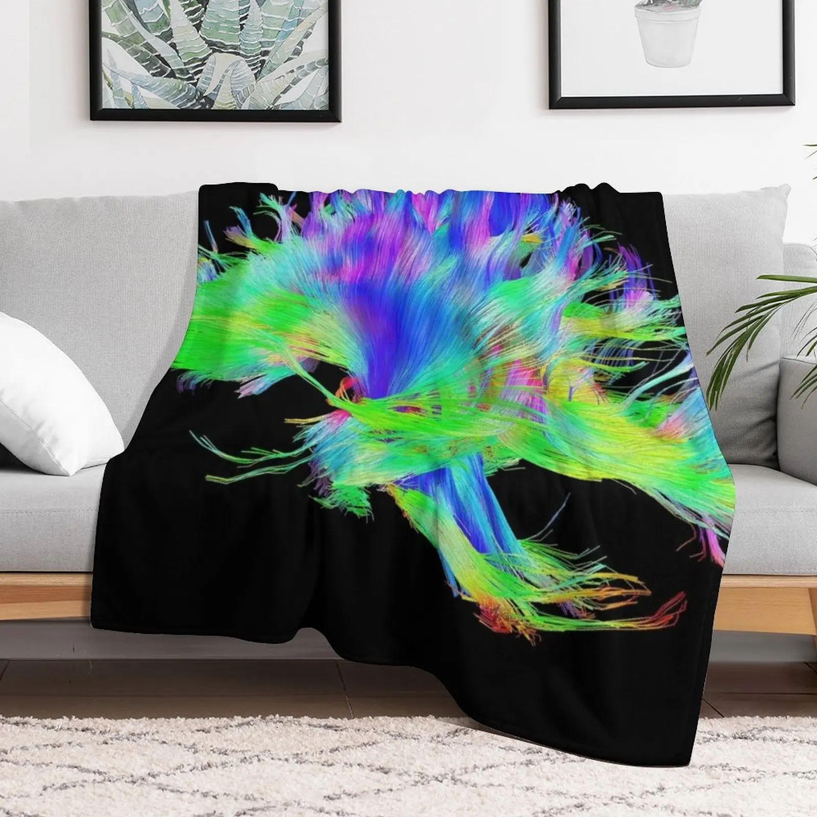 Fiber Tracts Of The Brain, Dti - 3D Printing For Medical review and price
